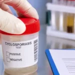 EE.UU. confirma las primeras muertes por brote de ciclosporiasis mientras aumentan los contagios