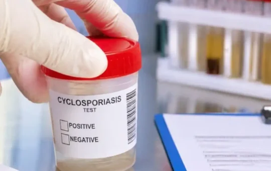EE.UU. confirma las primeras muertes por brote de ciclosporiasis mientras aumentan los contagios