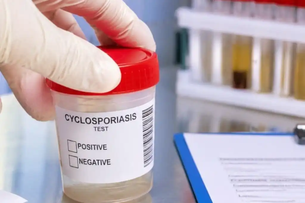 EE.UU. confirma las primeras muertes por brote de ciclosporiasis mientras aumentan los contagios